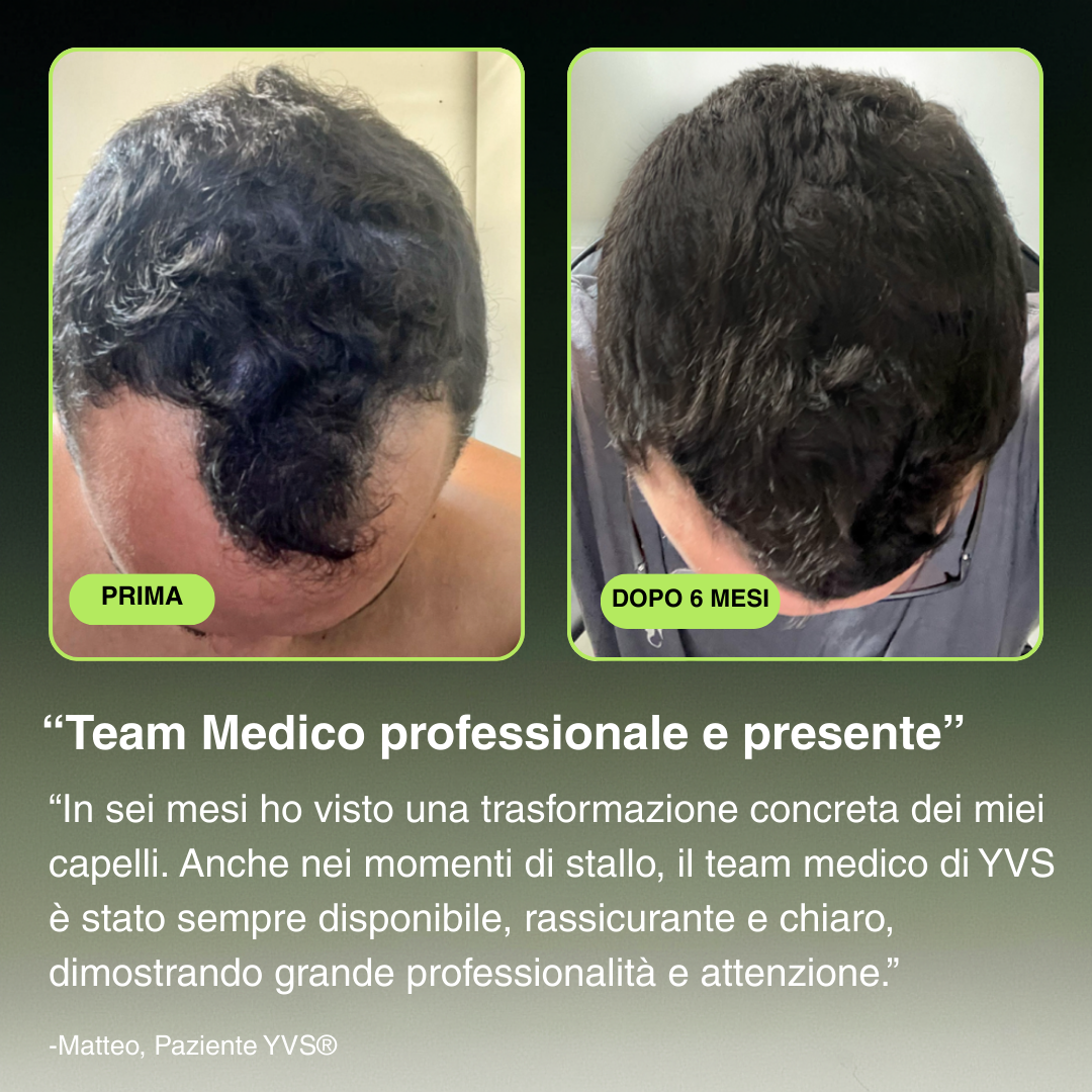 YVS - Sistema di Microinfusione Avanzata per la ricrescita dei capelli