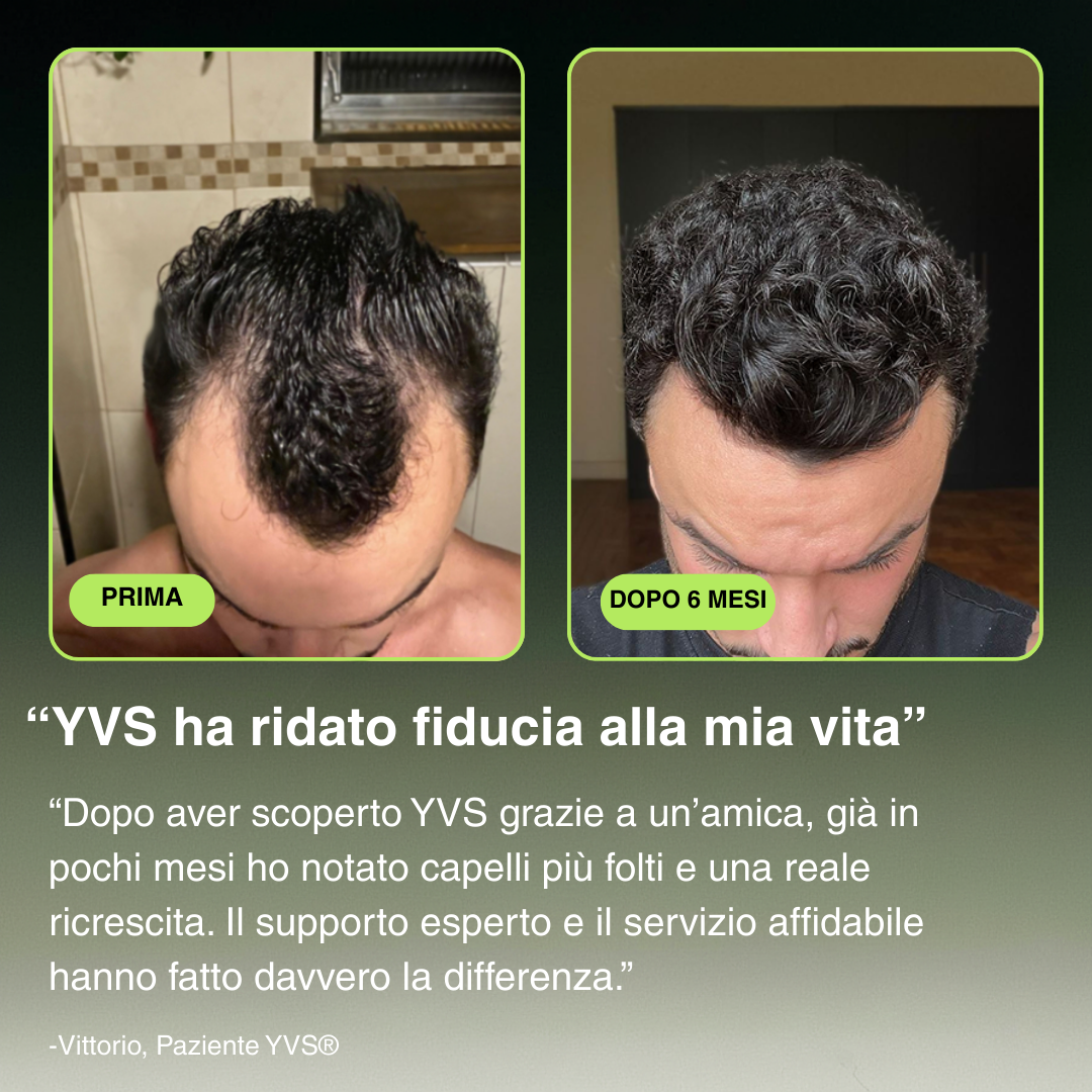 YVS - Sistema di Microinfusione Avanzata per la ricrescita dei capelli