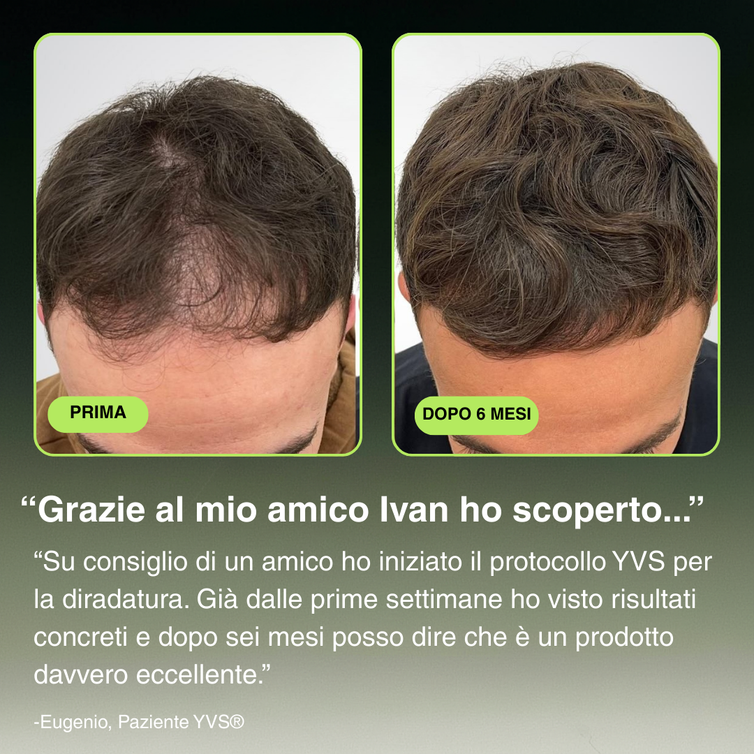 YVS - Sistema di Microinfusione Avanzata per la ricrescita dei capelli
