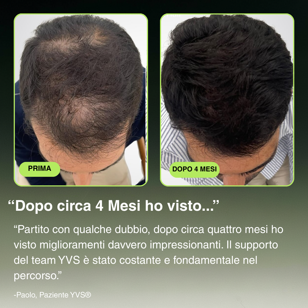 YVS® Pico-Infuse™ Microinfusione Avanzata