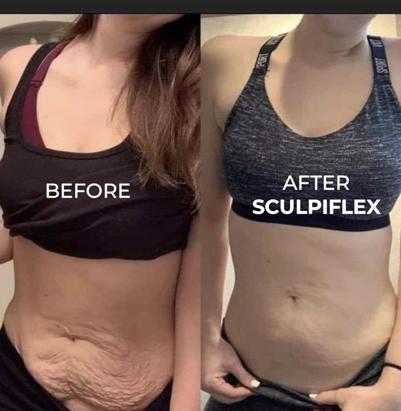 Sculpiflex Body Sculpting Device